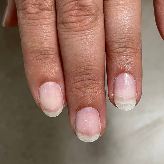 Create an Extension Using PROFORMS